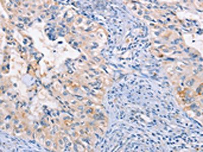 CCR5 Antibody