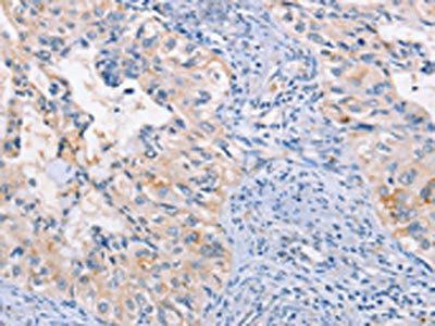 CCR5 antibody