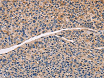 CCR5 Antibody