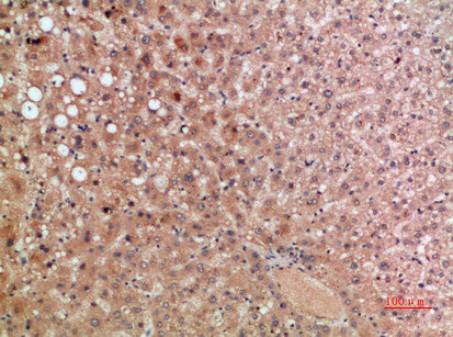 CCR5 antibody