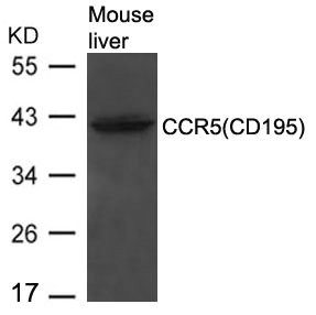 CCR5 antibody