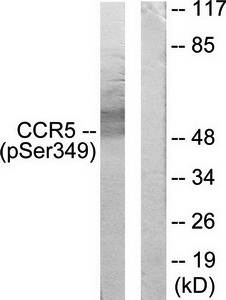 CCR5 (Phospho-Ser349) Antibody