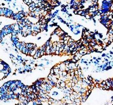 Anti-C-C chemokine receptor type 5 CCR5 Antibody