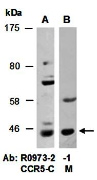 CCR5 antibody