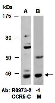 CCR5 (M) Antibody, Rabbit Polyclonal