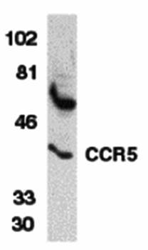 CCR5 Antibody