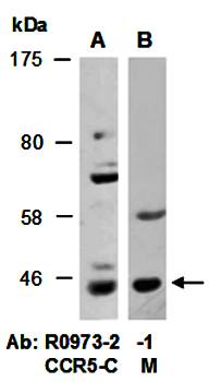 CCR5 (vPairTM) Antibodies