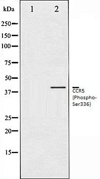 CCR5 (Phospho-Ser336) antibody