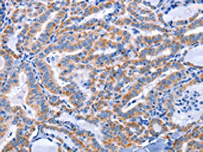 CCR6 antibody