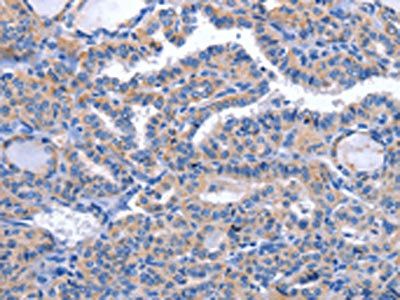 CCR6 Antibody
