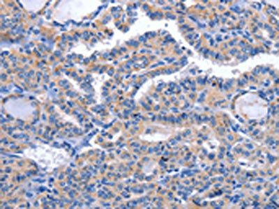 CCR6 antibody