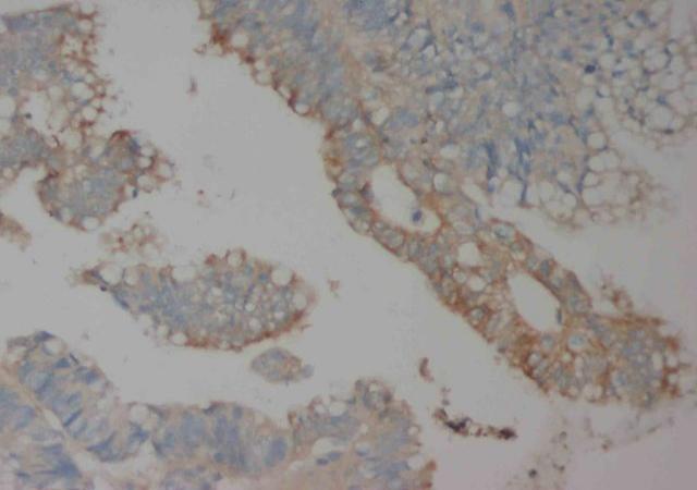 Anti-CCR6/CCR6 Antibody