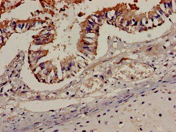 CCR7 Antibody