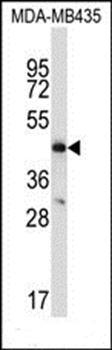 CCR9 antibody