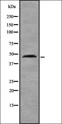 CCRN4L antibody