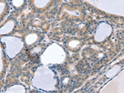 CCS Antibody