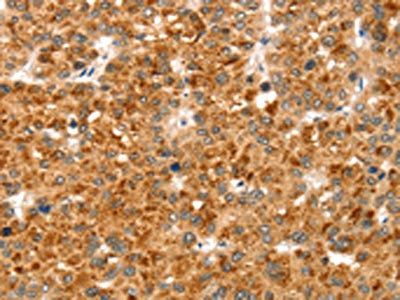 CCS Antibody