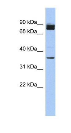 CCSER1 antibody