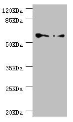 CCT5 antibody