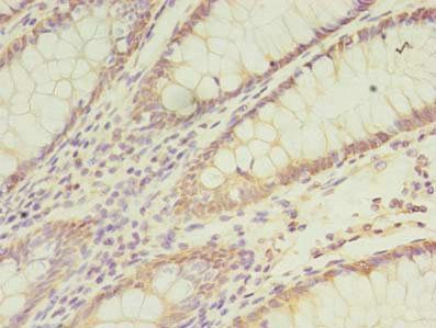CCT6B Antibody