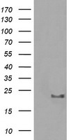 CD10 (MME) antibody