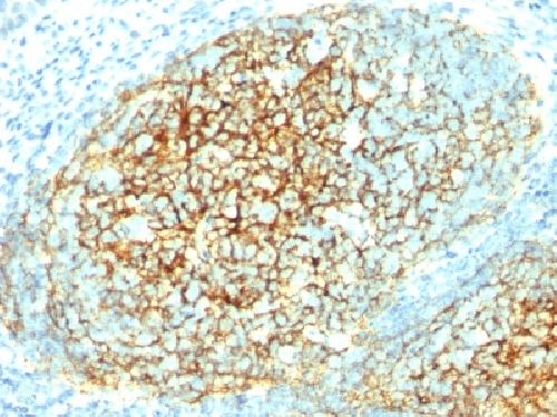 CD106 antibody