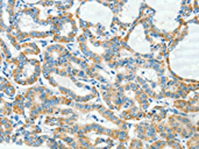 CD106 antibody