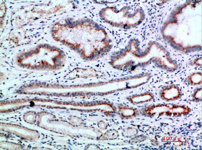 CD106 antibody