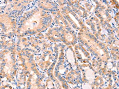 CD109 antibody