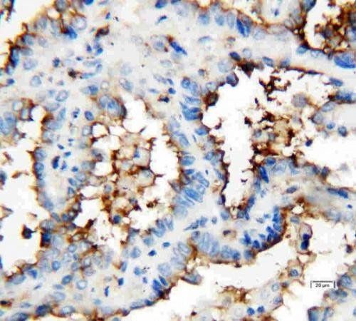 CD133 antibody