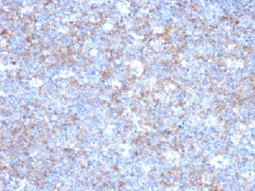MCAM Antibody