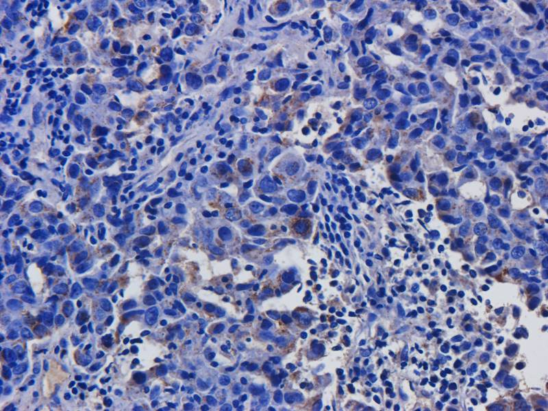 CD146 antibody