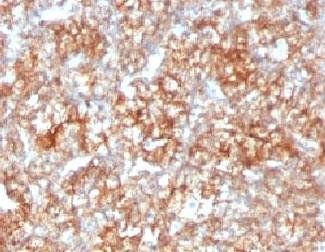 CD147 / Emmprin / Basigin Antibody