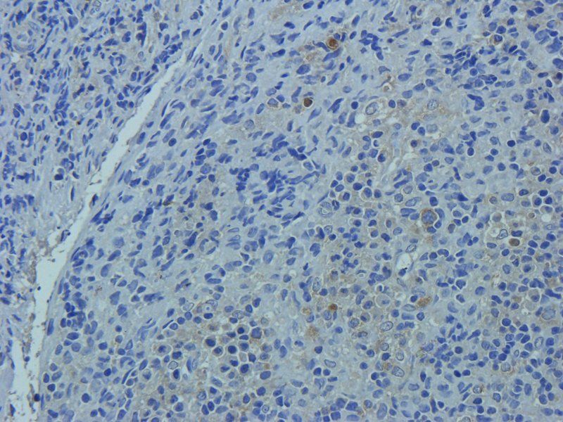 CD14 antibody