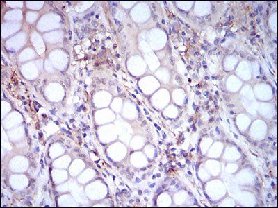 CD14 Antibody