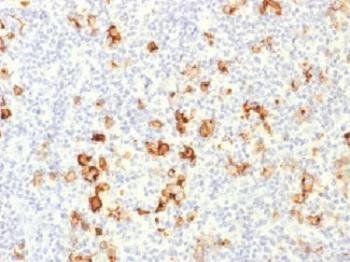 CD15 Antibody / SSEA-1