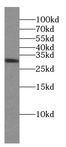 CD154 antibody
