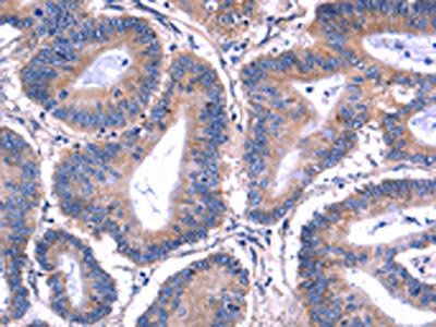 PVR Antibody