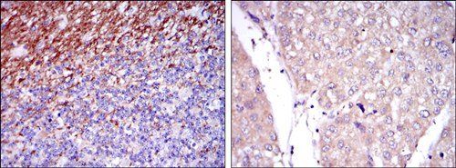 CD15 Antibody