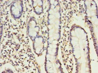 CD160 Antibody
