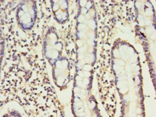 CD160 antibody