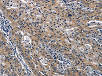 CD160 antibody