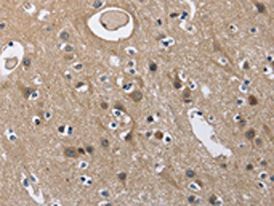 CD160 Antibody