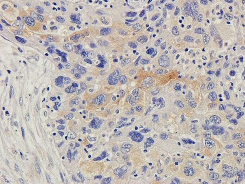 CD168 antibody