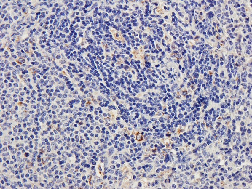 CD170 antibody