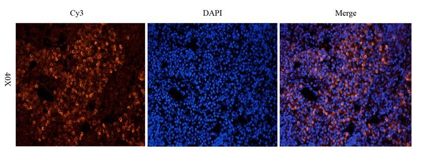 CD19 Rabbit Polyclonal Antibody