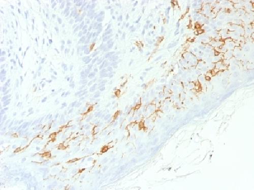 Recombinant CD1a / HTA1 (Mature Langerhans Cells Marker) Antibody