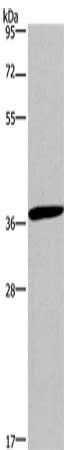 CD1A antibody