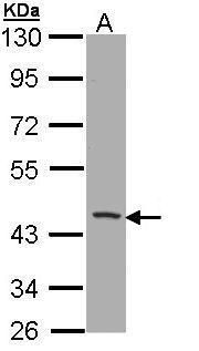 CD1b antibody