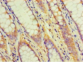 CD2 Antibody